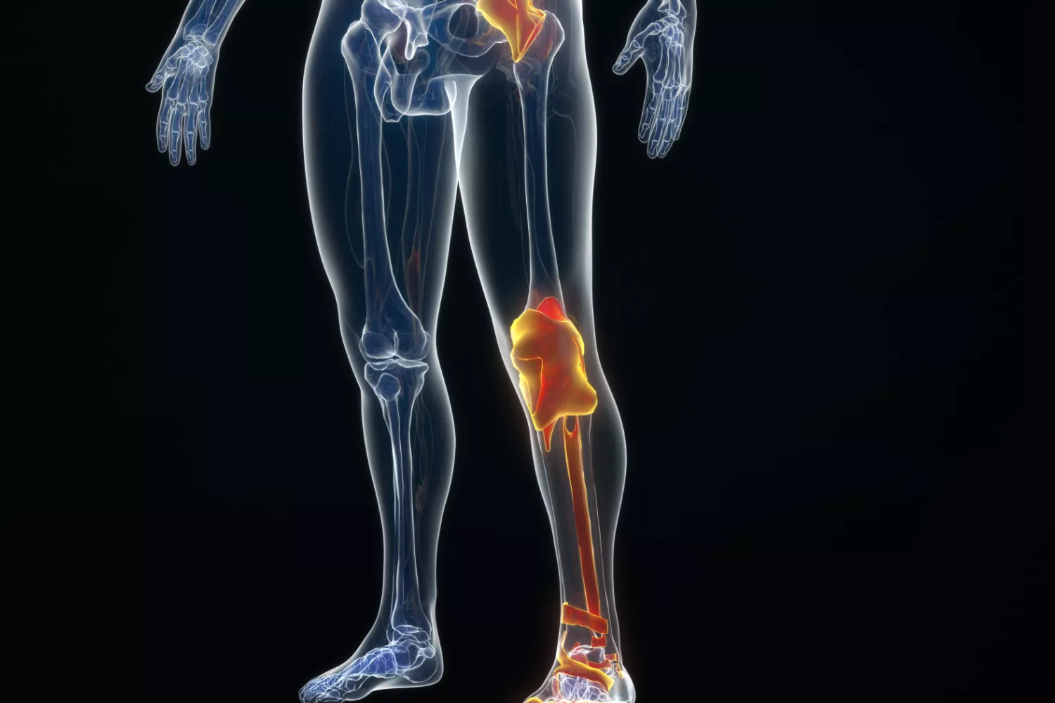 磁力共振(MRI)关节检查