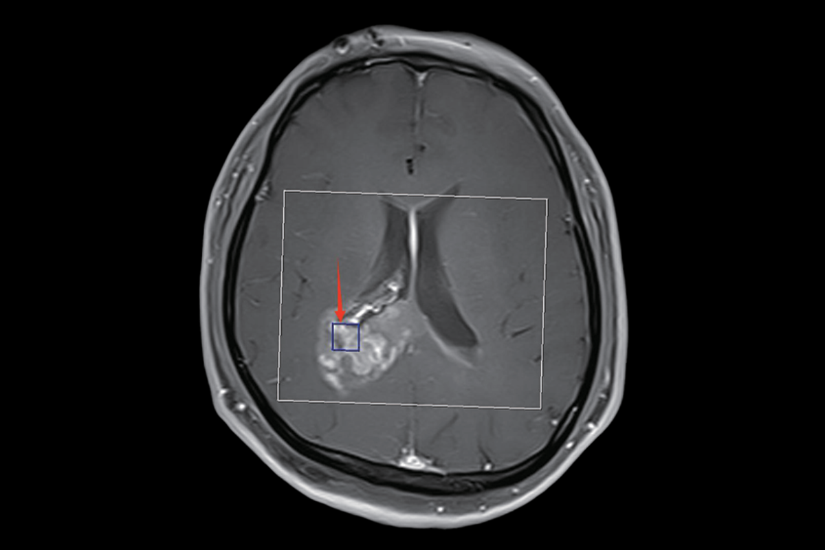波譜成像（定位像）