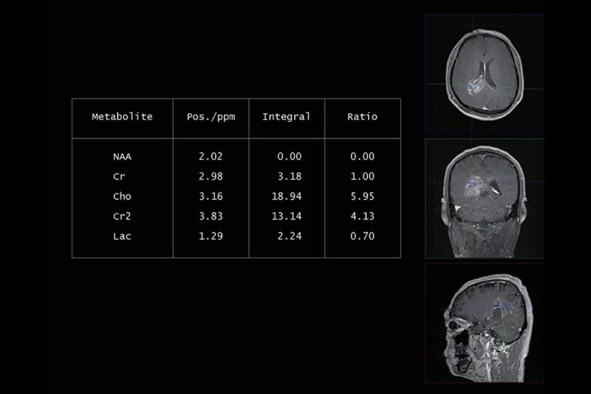 波譜成像（數據表）